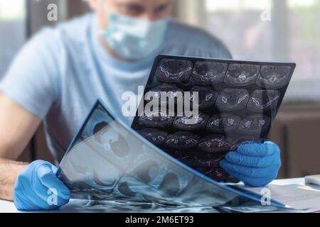 Mri Sampling Mask Doctor in mask examines and compares two MRI scans Stock Photo - Alamy