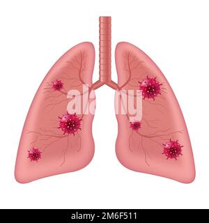 Lungs Human Internal Organ With Coronavirus Isolated White Background Stock Photo