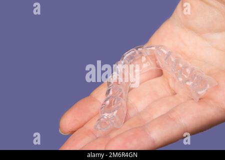 orthodontic treatment, invisible braces, new orthodontic technology, Occlusal Splint Stock Photo