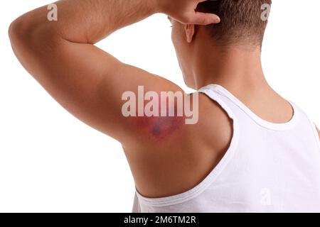 Man with bruise on shoulder against white background Stock Photo