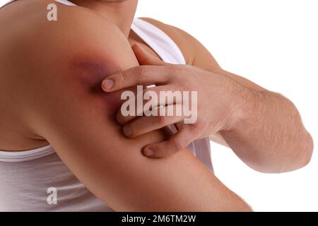 Man with bruise on shoulder against white background, closeup Stock Photo