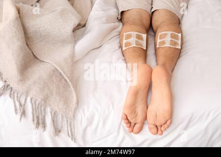 Ill man with mustard plasters on his legs lying in bedroom, closeup Stock Photo