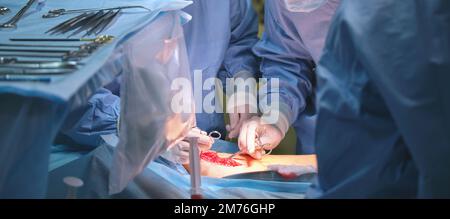 Closeup of doctors hands operating a patient conducting open cut surgery in surgical room. Healthcare and medical intervention concept Stock Photo