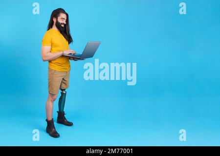 Smiley man with prosthetic leg standing using a laptop Stock Photo