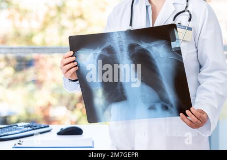 Doctor diagnosing patient’s health on asthma, lung disease, long COVID-19, coronavirus or bone cancer illness with radiological chest x-ray film for m Stock Photo
