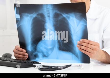 Man Doctor Looking at X-Ray Radiography in patient's Room with lung disease, long COVID-19 at hospital Stock Photo