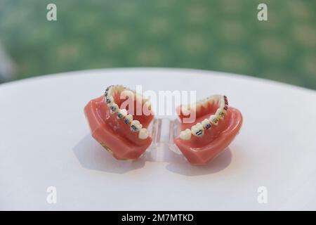 Teeth model wire dental braces isolated on white background, save ...