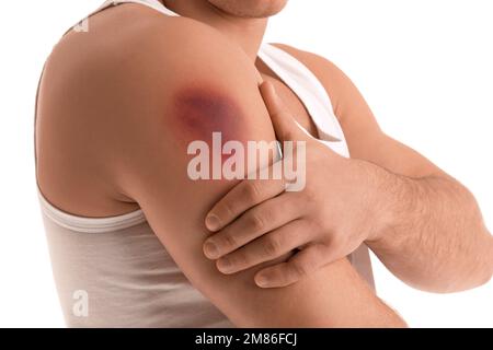 Man with bruise on shoulder against white background, closeup Stock Photo