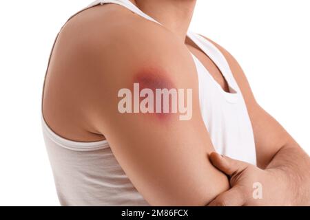 Man with bruise on shoulder against white background, closeup Stock Photo