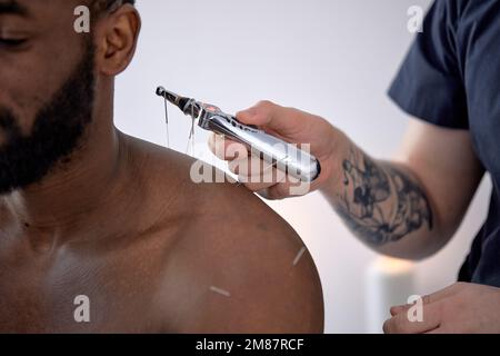 cropped doctor sticks needles into black male body on the acupuncture, using device. unrecognizable skilled professional doctor treating male client, Stock Photo