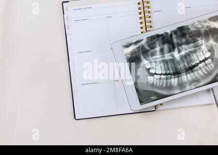 Using digital tablet doctor reviews results of panoramic image dental x-ray examination in order to prescribe an effective treatment for patient. Stock Photo
