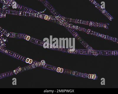 Nodularia Algae Under Microscopic View, X100, Nitrogen-fixing 