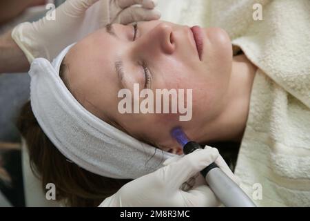 Mesotherapy. Woman having dermapen facial treatment. Micro needle cosmetic treatment at dermatologist. Stock Photo