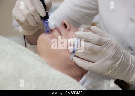 Mesotherapy. Woman having dermapen facial treatment. Micro needle cosmetic treatment at dermatologist. Stock Photo