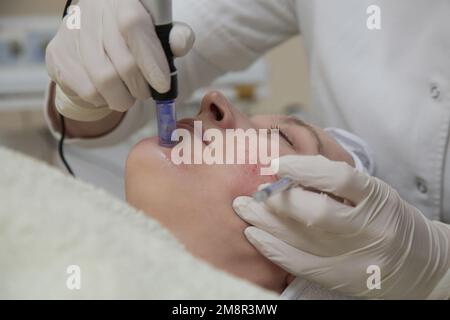 Mesotherapy. Woman having dermapen facial treatment. Micro needle cosmetic treatment at dermatologist. Stock Photo