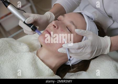 Mesotherapy. Woman having dermapen facial treatment. Micro needle cosmetic treatment at dermatologist. Stock Photo