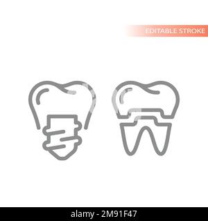 Dental implant and crown line vector icon. Tooth implantology outline symbol. Stock Vector
