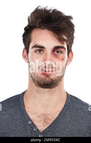 Portrait, man and abuse victim in studio, hurt and bruise, conflict and fight on white background. Face, male and facial injury, black eye and wound Stock Photo