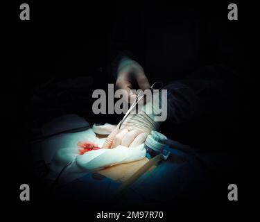 Close-up of a surgeon's hands in sterile gloves holding a needle holder and suture material during surgery. Suture thread. Selective focus. Stock Photo