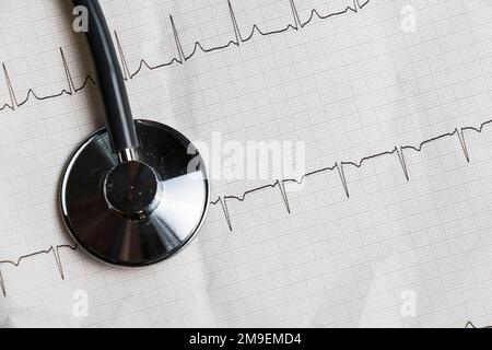 Cardiogram, waves of heart beat, EKG on the paper, arrhythmia Stock Photo