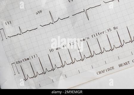 Cardiogram, waves of heart beat, EKG on the paper, arrhythmia Stock Photo