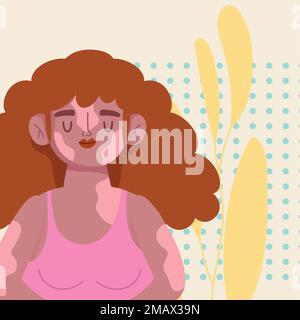 perfectly imperfect, woman with vitiligo Stock Vector