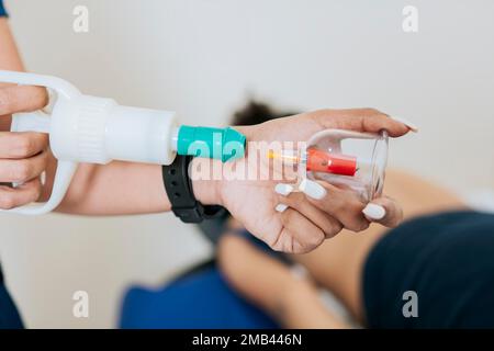 Close up of professional performing cupping treatment on patient, Modern Physiotherapy with cupping cups, Physiotherapist placing cupping on lying Stock Photo