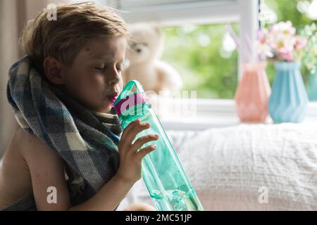 Young toddler with chickenpox. Sick child with chickenpox. Varicella virus or Chickenpox bubble rash on child. Portrait of little boy with pox. Stock Photo