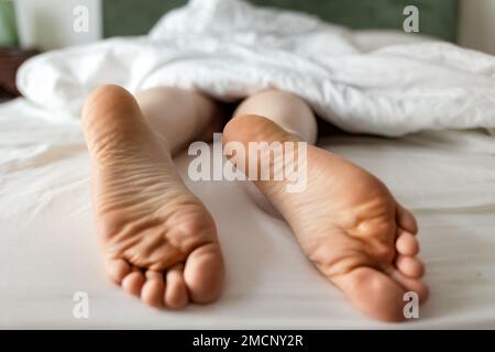 Person's legs sticking out under blanket. Barefeet close-up with dry calluses and corns. Stock Photo