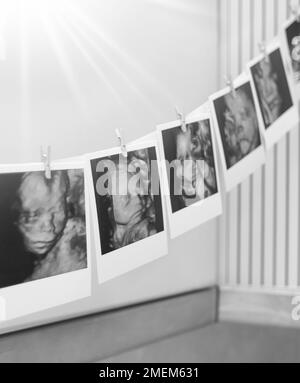 Collage of black and white photos story of ultrasound pictures of baby. Family, Childbirth, New Life concept background Stock Photo