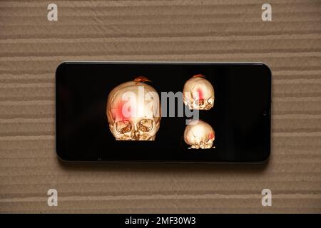 3D computed tomography of the brain with a fracture of the frontal part of the skull after injury on phone screens, mobile application Stock Photo