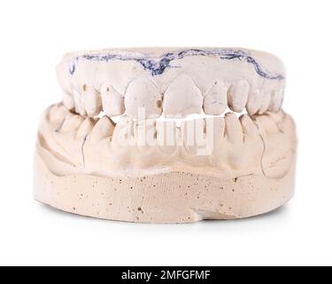 The cast of the jaw of the teeth from plaster isolated on white Stock Photo