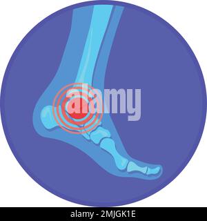 Anckle pain icon. Red spot in foot bone isolated on white background Stock Vector