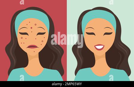 Unhappy teen girl struggling with acne. Before and after skin treatment Stock Vector