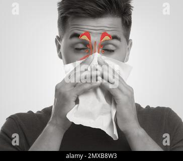 Man suffering from runny nose as allergy symptom. Sinuses illustration on face Stock Photo
