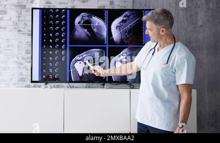 Physician Doctors Looking At Shoulder MRT Scan Stock Photo