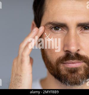 Close up portrait of middle aged bearded man, wanting to lift face to remove wrinkles and skin rejuvenation, cropped Stock Photo