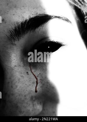 A vertical closeup shot of a female's face with the eye bleeding in grayscale Stock Photo