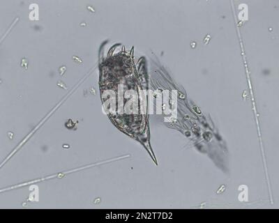 Freshwater aquatic zooplankton and algae under microscope view Stock Photo