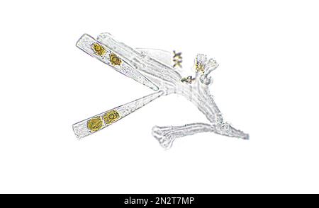 Licmophora sp. algae under microscopic view, diatoms, phytoplankton, fossils, silica, golden yellow algae Stock Photo