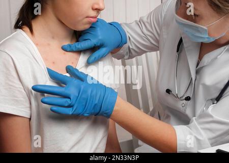 Doctor Checking Skin of Sick Girl. Kid with Red Rash being Examined at the Physician. Allergic Rash, Chicken pox, Monkeypox Symptoms on the Body of Ch Stock Photo