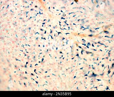 Kupffer cells are macrophages of the liver. Colloidal iron acts as a vital stain that can be introduced in the body being phagocyted by Kupffer cells, Stock Photo