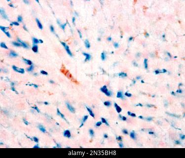 Kupffer cells are macrophages of the liver. Colloidal iron acts as a vital stain that can be introduced in the body being phagocyted by Kupffer cells, Stock Photo