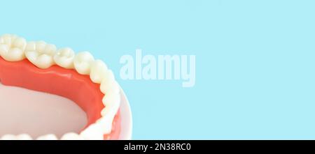 Dental Teeth Model dentures on blue background, close-up. Regular checkups are essential to oral health. Orthodontic tools, brace, bracket system, too Stock Photo