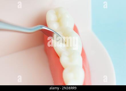 Dental prosthesis on blue background, close-up. Old age. Teeth. Jaw. Close-Up Of Dentures Against Blue Background. Denture picture with focus on teeth Stock Photo