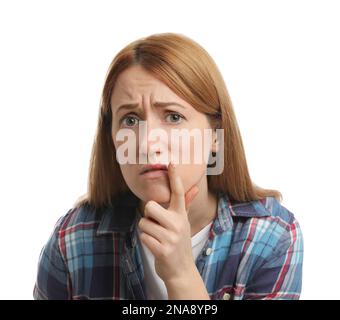 Upset woman with herpes applying cream on lips against white background Stock Photo