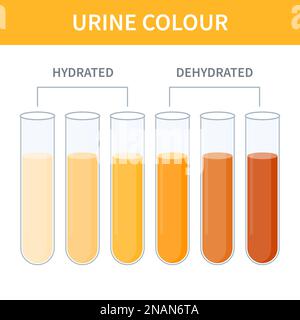 Urine Color Chart Stock Illustrations, Cliparts and Royalty Free