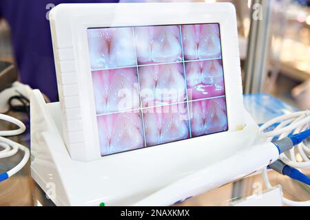 Teeth Camera Scan Scanning teeth with dental camera Stock Photo - Alamy