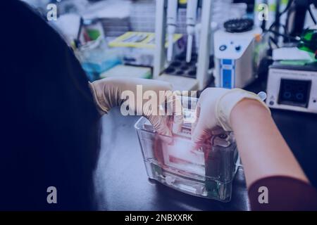 Western blot analysis use as protein analysis for protein detection. This technique use in medical or research laboratory. Also, the method detect HIV Stock Photo