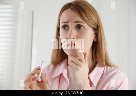 Upset woman with herpes applying cream on lips indoors Stock Photo